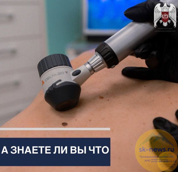 А знаете ли вы, что родинки (невусы) на мужском теле статистически опаснее, чем на женском?